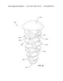 SELF-OSTEOTOMIZING BONE IMPLANT AND RELATED METHOD diagram and image