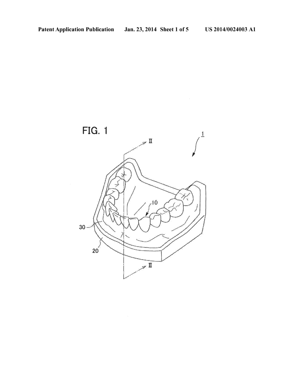 TOOTH MODEL USED FOR DENTAL TRAINING AND METHOD OF MANUFACTURING  SAME - diagram, schematic, and image 02