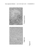 BIOMARKERS AND METHODS OF USE THEREOF diagram and image