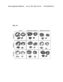 COMPOSITIONS AND METHODS FOR THE TREATMENT AND PREVENTION OF CARDIAC     ISCHEMIC INJURY diagram and image