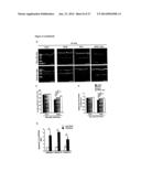 METHODS AND COMPOSITIONS FOR PRESERVING RETINAL GANGLION CELLS diagram and image