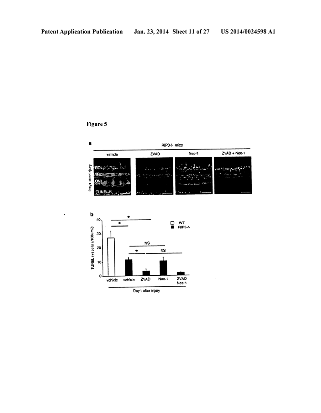 METHODS AND COMPOSITIONS FOR PRESERVING RETINAL GANGLION CELLS - diagram, schematic, and image 12