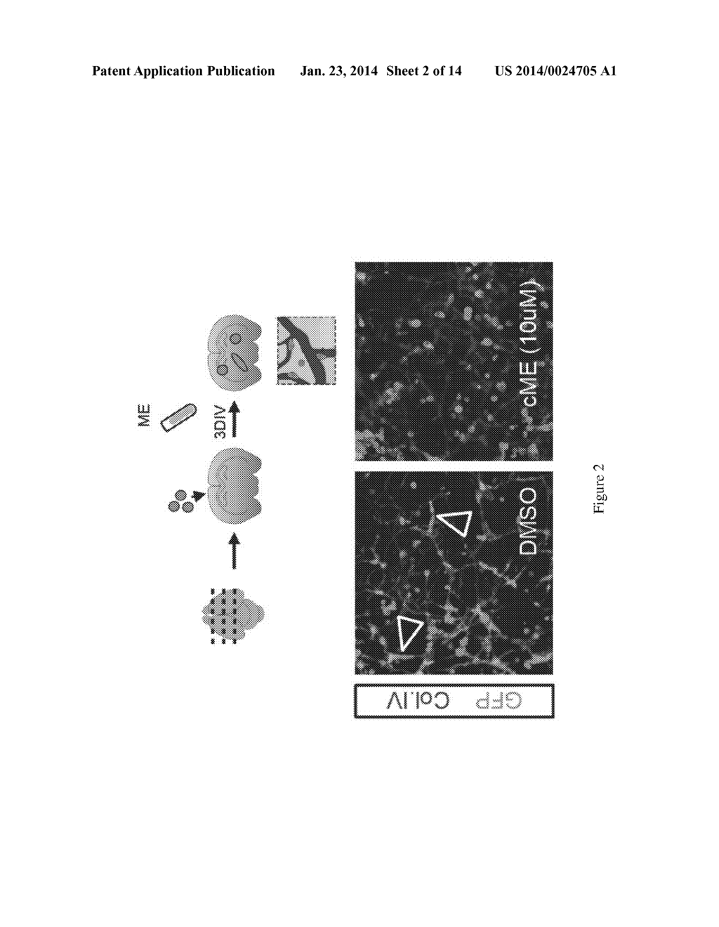 MIGRASTATINS AND USES THEREOF - diagram, schematic, and image 03