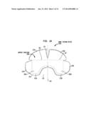 BOWEL PACKING DEVICE HAVING A SUPPORT STRUCTURE diagram and image