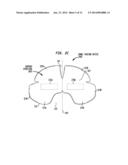 BOWEL PACKING DEVICE HAVING A SUPPORT STRUCTURE diagram and image