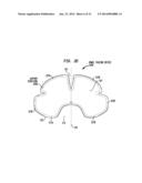 BOWEL PACKING DEVICE HAVING A SUPPORT STRUCTURE diagram and image