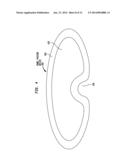 BOWEL PACKING DEVICE HAVING A SUPPORT STRUCTURE diagram and image