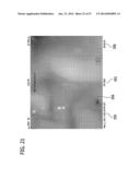 Imaging Catheter Assembly diagram and image