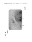 Imaging Catheter Assembly diagram and image