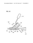 Imaging Catheter Assembly diagram and image