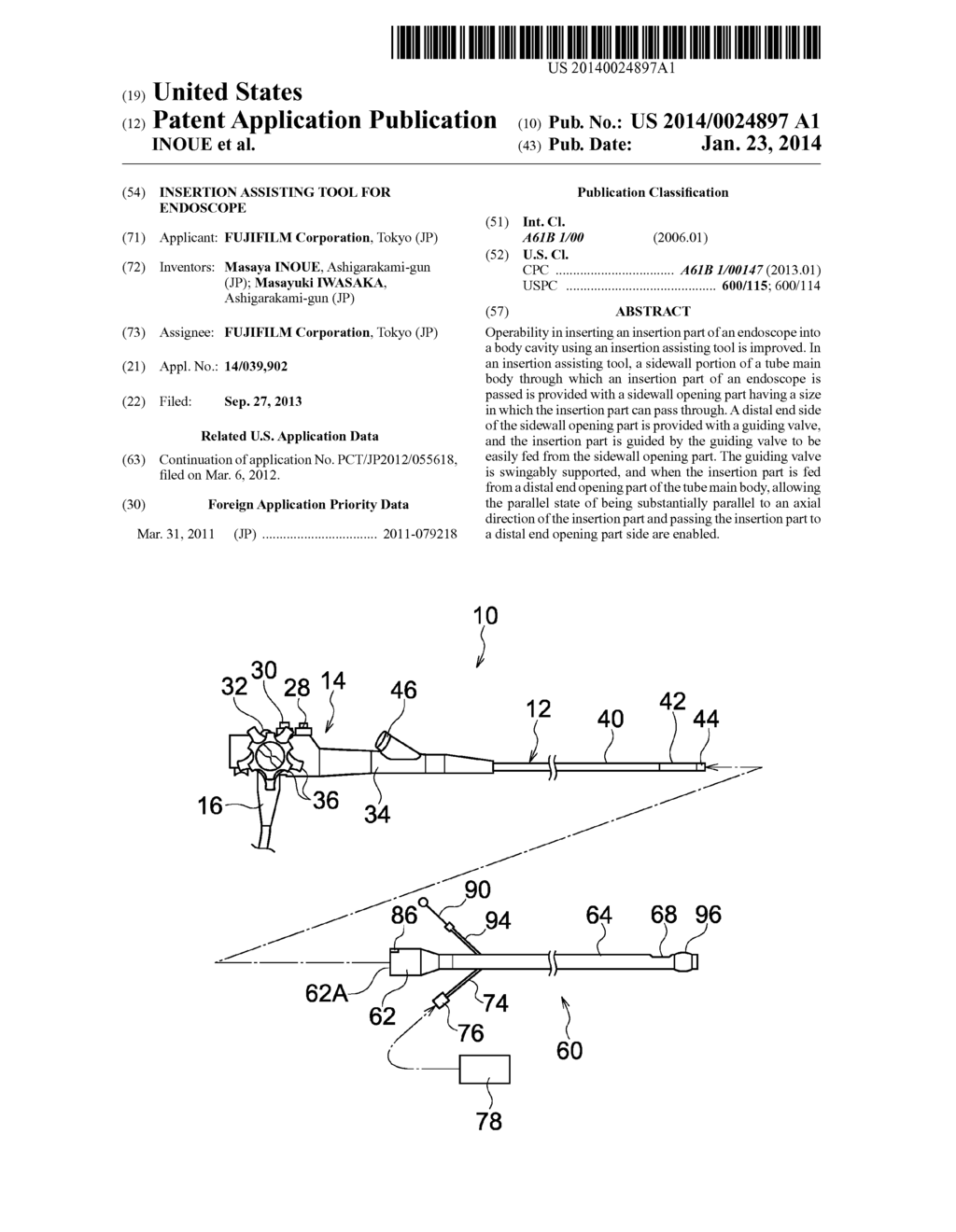 INSERTION ASSISTING TOOL FOR ENDOSCOPE - diagram, schematic, and image 01