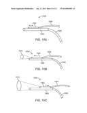 ILLUMINATED SUCTION APPARATUS diagram and image