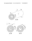 MRI-GUIDED CATHETERS diagram and image