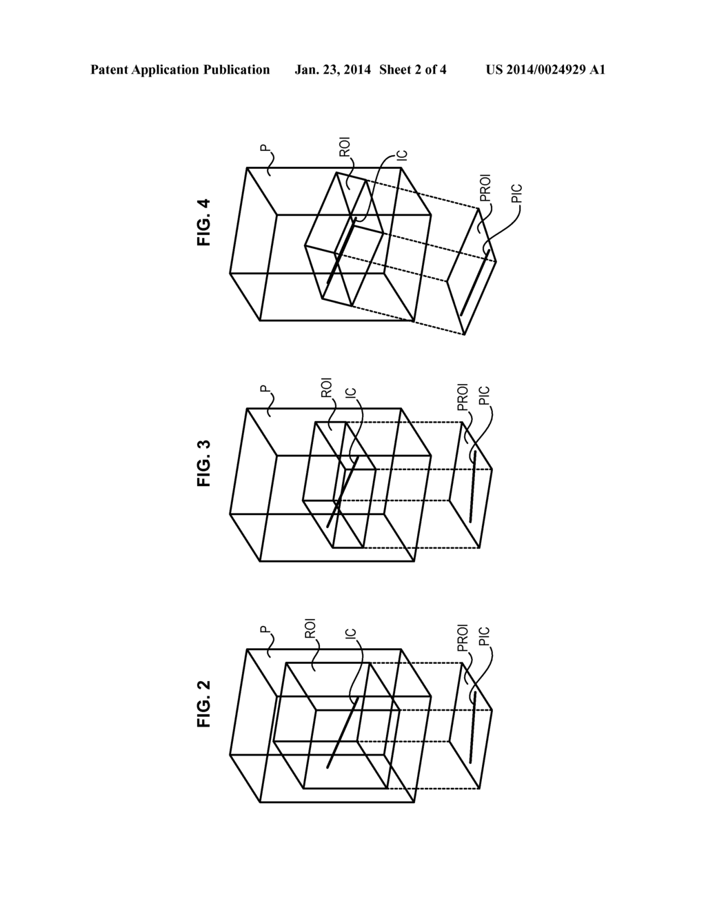 IMAGE PROCESSING METHOD AND SYSTEM FOR 3D DISPLAY OF A PATIENT'S ORGAN - diagram, schematic, and image 03