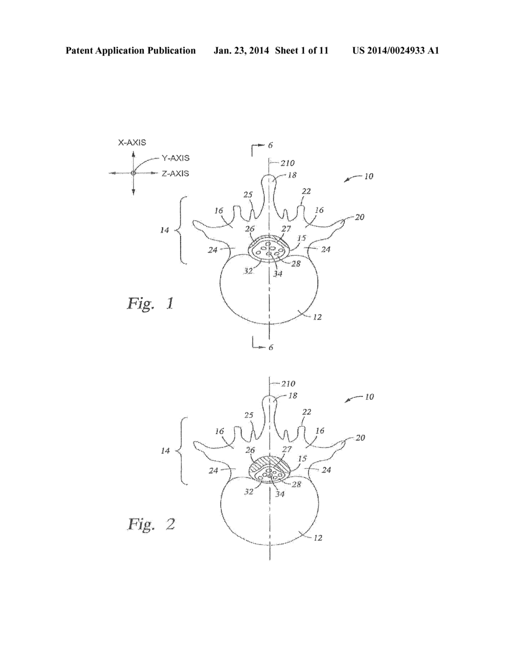 Percutaneous Tissue Excision Devices And Methods - diagram, schematic, and image 02