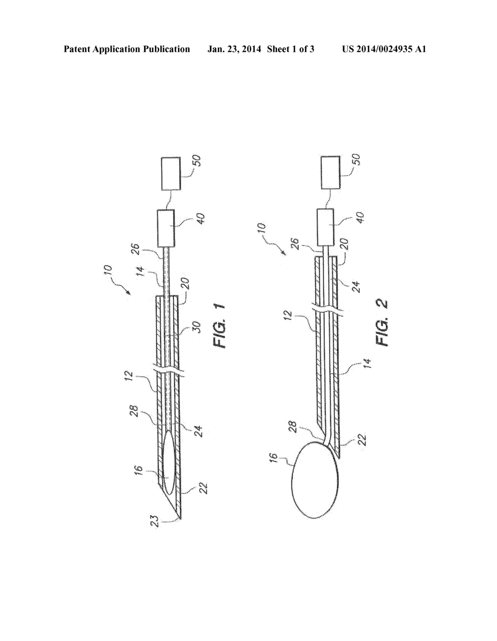 ECHOGENIC OCCLUSIVE BALLOON AND DELIVERY SYSTEM - diagram, schematic, and image 02