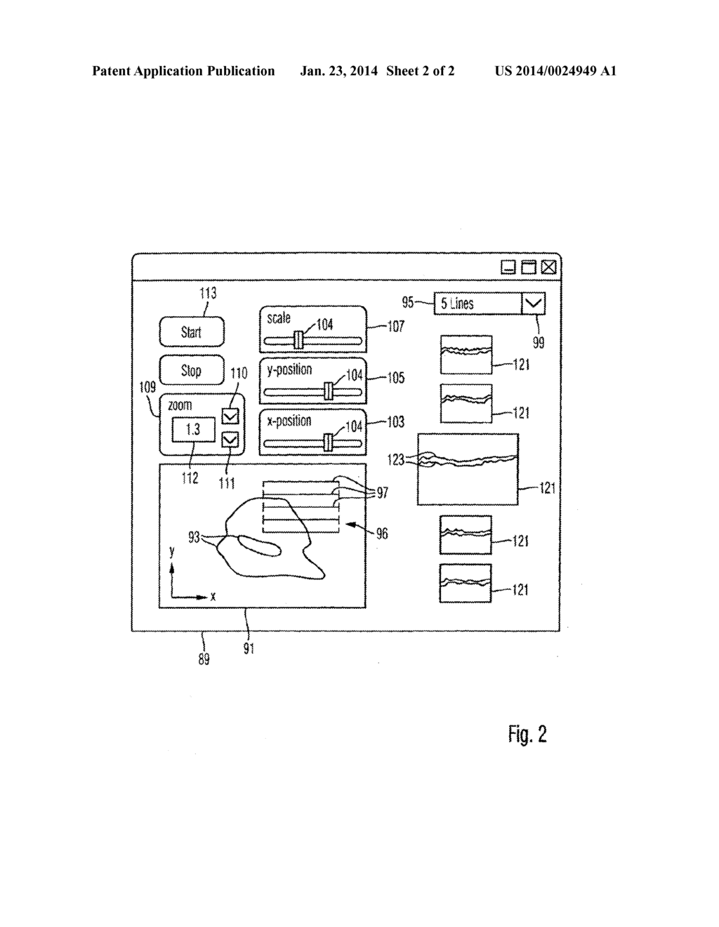 SURGICAL MICROSCOPY SYSTEM INCLUDING AN OCT SYSTEM - diagram, schematic, and image 03