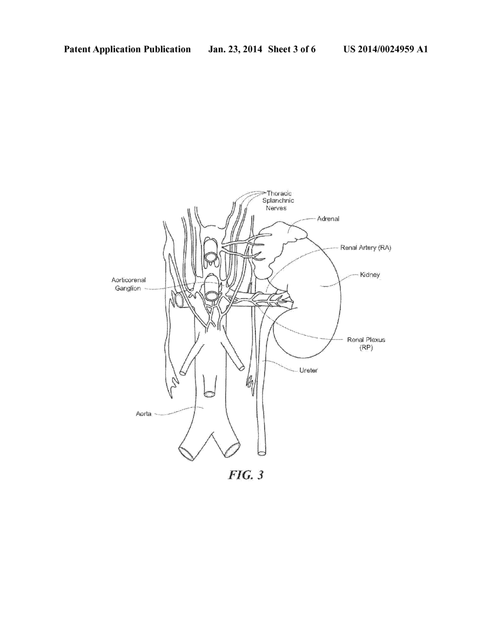 THERAPEUTIC RENAL NEUROMODULATION FOR TREATING DYSPNEA  AND ASSOCIATED     SYSTEMS AND METHODS - diagram, schematic, and image 04