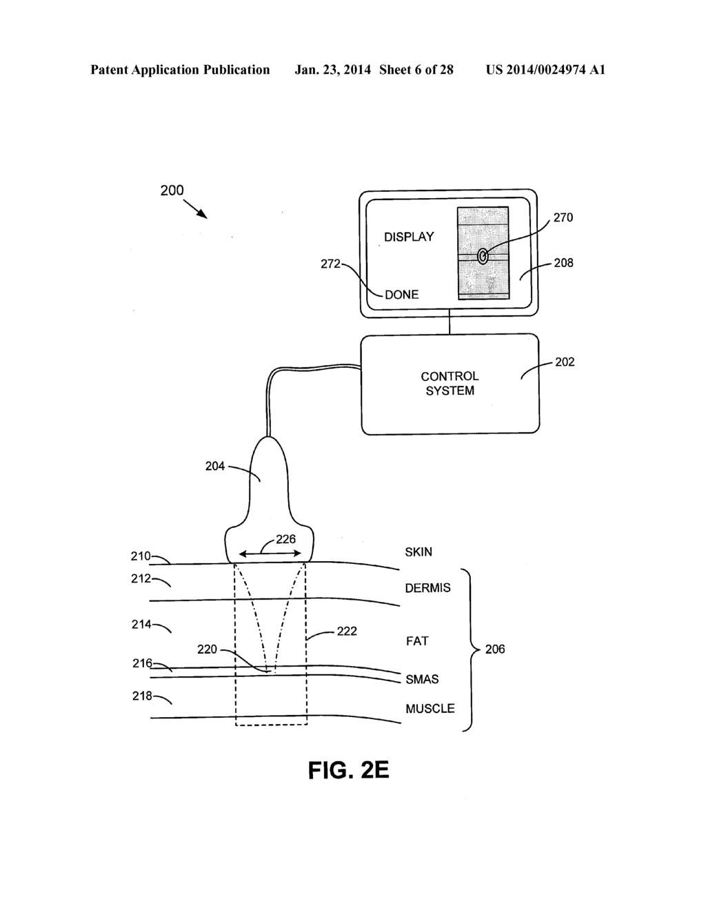 METHODS FOR NONINVASIVE SKIN TIGHTENING - diagram, schematic, and image 07