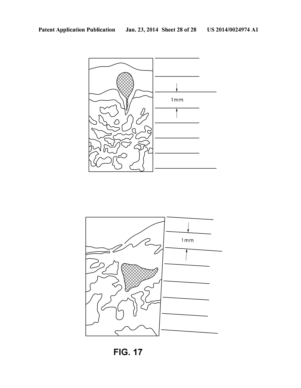 METHODS FOR NONINVASIVE SKIN TIGHTENING - diagram, schematic, and image 29