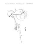 FLEXIBLE, SELF EXPANSIBLE, REMOVABLE MEMORY COIL INTRAGASTRIC DEVICE AND     METHOD OF USING SUCH DEVICE FOR WEIGHT REDUCTION AND MEDICATION DELIVERY diagram and image