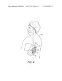 FLEXIBLE, SELF EXPANSIBLE, REMOVABLE MEMORY COIL INTRAGASTRIC DEVICE AND     METHOD OF USING SUCH DEVICE FOR WEIGHT REDUCTION AND MEDICATION DELIVERY diagram and image