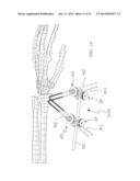 CLAMP FOR TEMPORARY OR DEFINITIVE EXTERNAL ORTHOPAEDIC FIXATION, AND     EXTERNAL FIXATION SYSTEM COMPRISING SAID CLAMP diagram and image