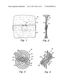 DOUBLE SPIRAL PATENT FORAMEN OVALE CLOSURE CLAMP diagram and image