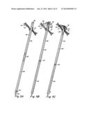 DOUBLE SPIRAL PATENT FORAMEN OVALE CLOSURE CLAMP diagram and image