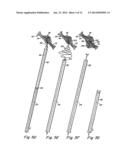 DOUBLE SPIRAL PATENT FORAMEN OVALE CLOSURE CLAMP diagram and image