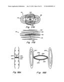 DOUBLE SPIRAL PATENT FORAMEN OVALE CLOSURE CLAMP diagram and image