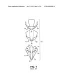 IMPLANTABLE MESH PROSTHESES AND METHOD OF MANUFACTURING SAME diagram and image