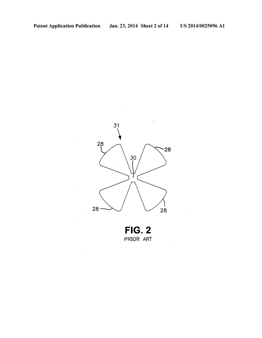 IMPLANTABLE MESH PROSTHESES AND METHOD OF MANUFACTURING SAME - diagram, schematic, and image 03