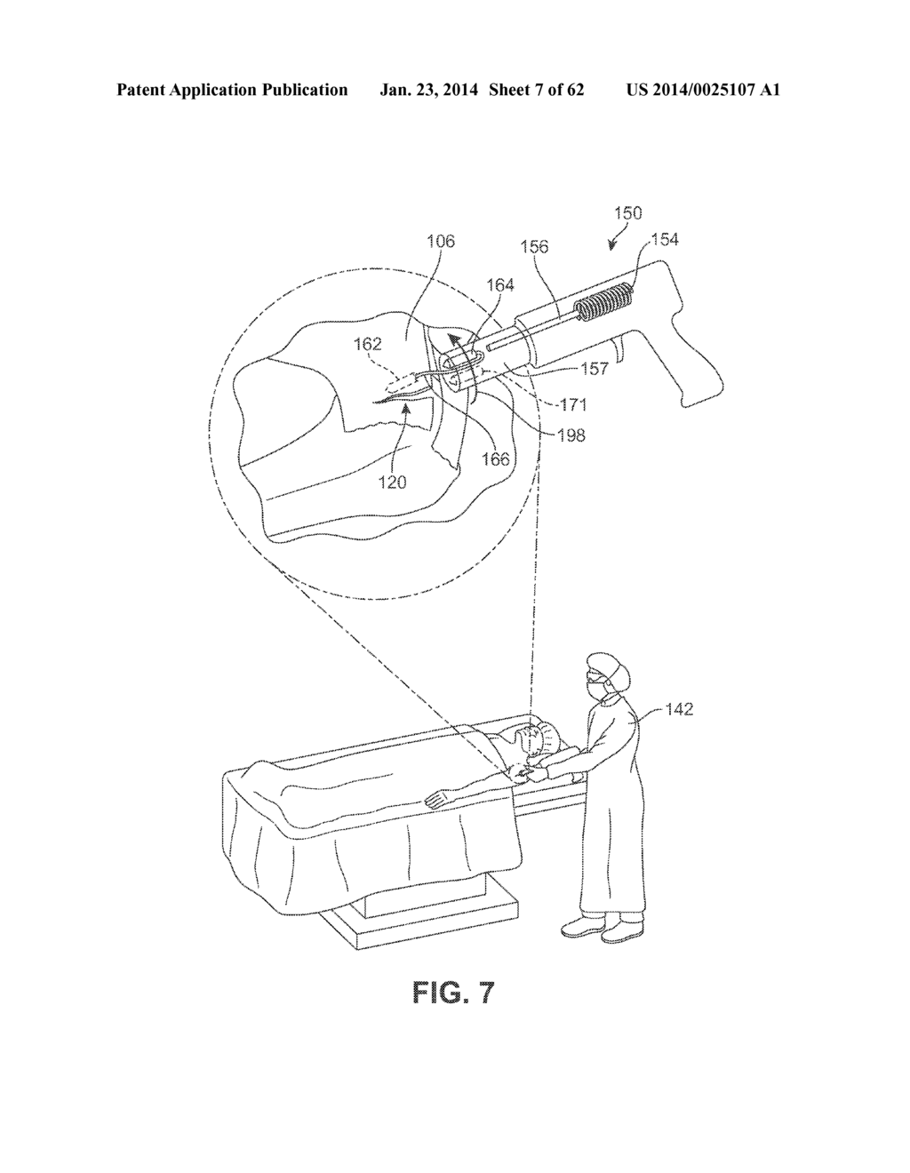 Detachable Front Delivery Assembly for a Tissue Repair System - diagram, schematic, and image 08