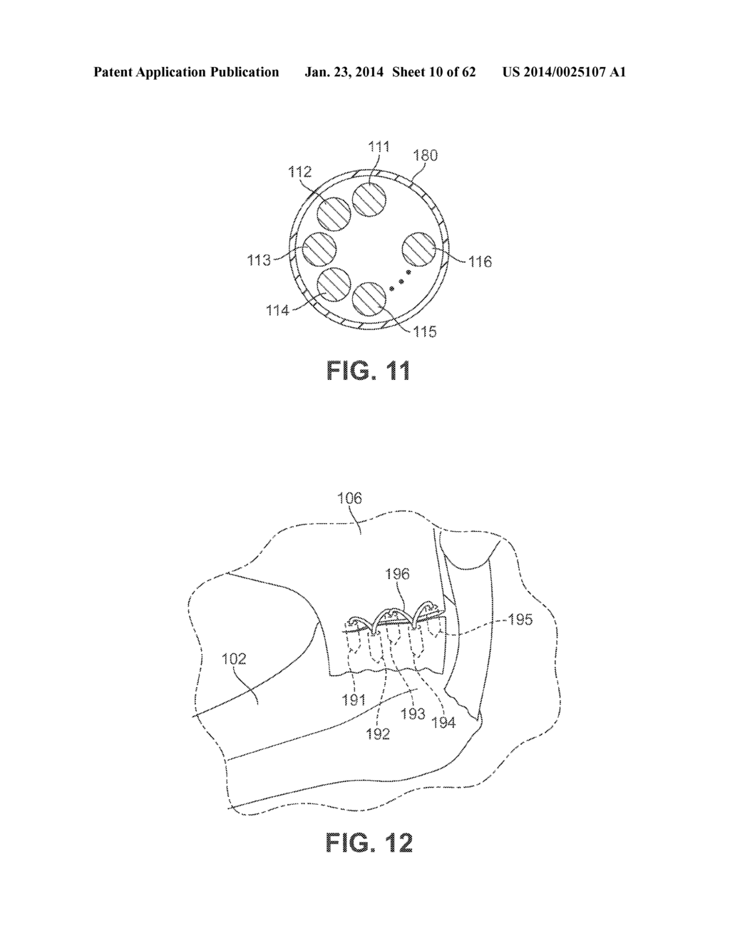 Detachable Front Delivery Assembly for a Tissue Repair System - diagram, schematic, and image 11