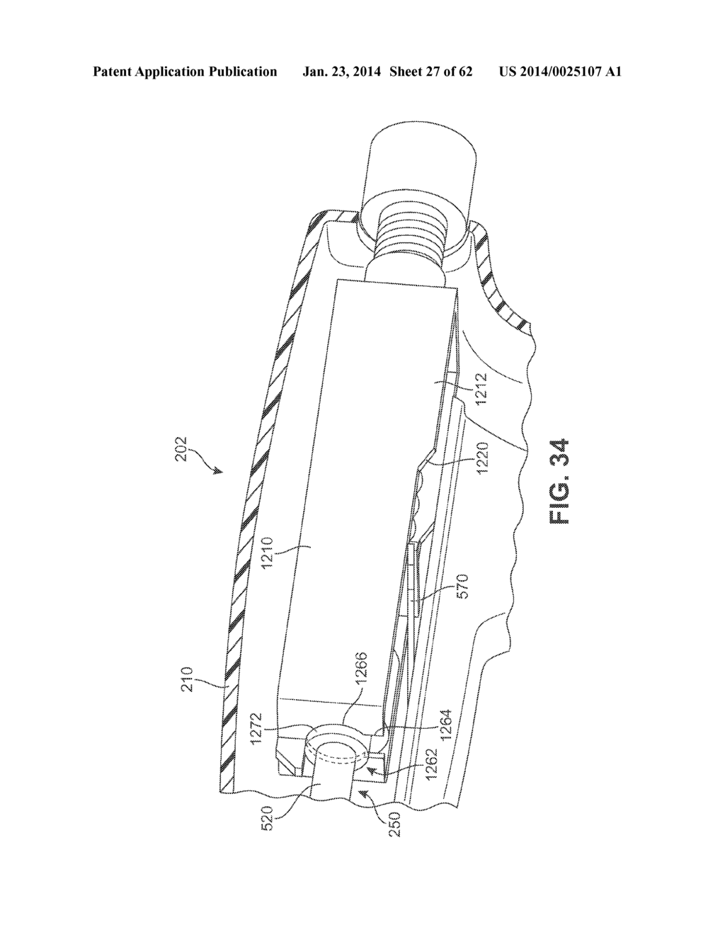 Detachable Front Delivery Assembly for a Tissue Repair System - diagram, schematic, and image 28