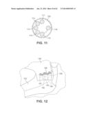 Multi-Impact System for Prosthesis Deployment Device diagram and image