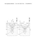 Multi-Impact System for Prosthesis Deployment Device diagram and image