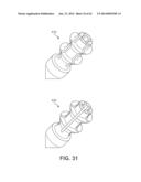 Multi-Impact System for Prosthesis Deployment Device diagram and image