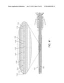 Multi-Impact System for Prosthesis Deployment Device diagram and image