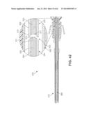 Multi-Impact System for Prosthesis Deployment Device diagram and image