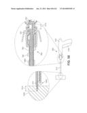 Multi-Impact System for Prosthesis Deployment Device diagram and image