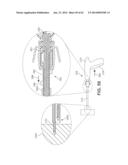 Multi-Impact System for Prosthesis Deployment Device diagram and image