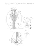 Multi-Impact System for Prosthesis Deployment Device diagram and image