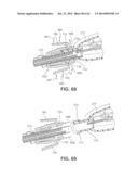 Multi-Impact System for Prosthesis Deployment Device diagram and image