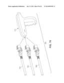 Multi-Impact System for Prosthesis Deployment Device diagram and image