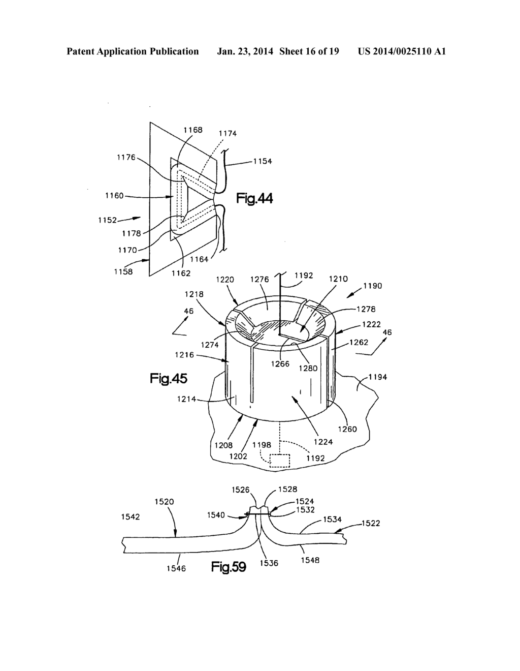 APPARATUS AND METHOD FOR SECURING A SUTURE - diagram, schematic, and image 17