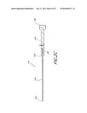 SPINAL IMPLANT diagram and image