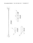 SPINAL IMPLANT diagram and image