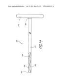 SPINAL IMPLANT diagram and image